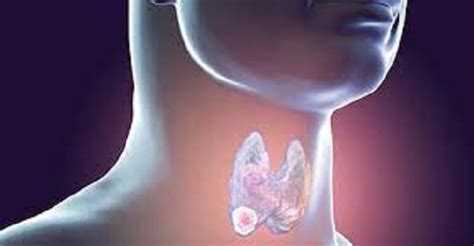 Doctor Says “oral Sex Is A Leading Factor In The Throat Cancer ‘epidemic’ In The U S The
