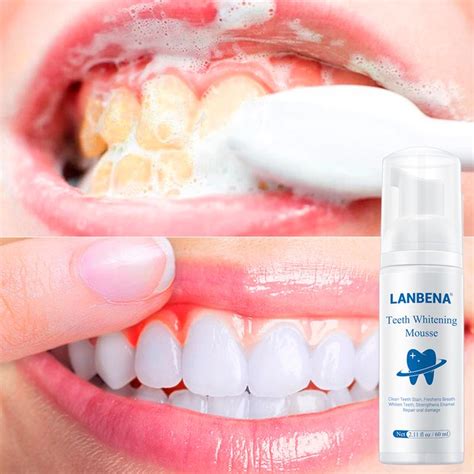 Buy Teeth Whitening Essence Powder Oral Hygiene Cleaning Serum Removes