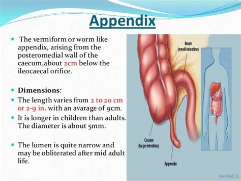 Appendicectomy