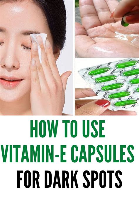 While vitamin e has lots of benefits, too much can lead to health issues. Benefits Of Vitamin E Capsules | How To Use For Skin and ...