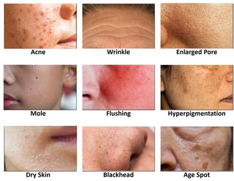 Applied Sciences Free Full Text High Performing Facial Skin Problem