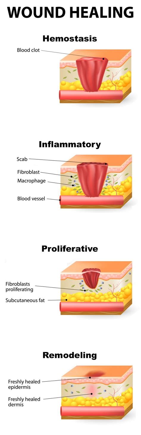 Describe The Four Stages Of Wound Healing