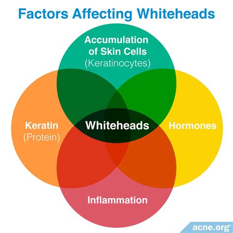 What Is A Whitehead
