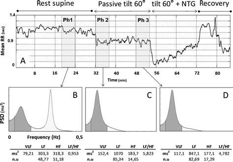 Heart Rate Variability Analysis During Head Up Tilt Test Predicts