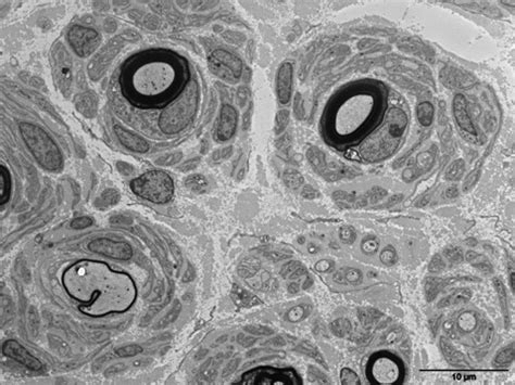Cet accord de financement, à hauteur de 81. AJNS - African Journal of Neurological Sciences | » LA ...