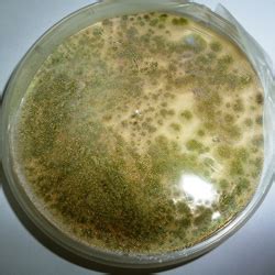 Cultural characteristics of aspergillus flavus. Aspergillus flavus: tout savoir sur cette moisissure ...