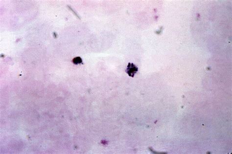 Free Picture Micrograph Plasmodium Malariae Microgametocyte