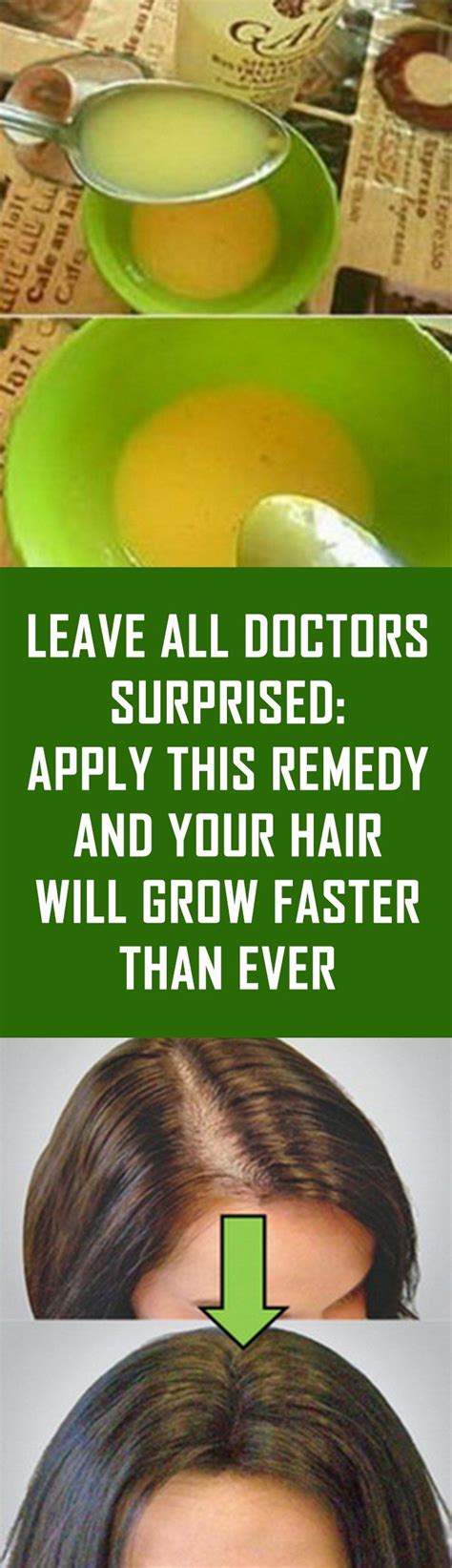 Leave All Doctors Surprised Apply This Remedy And Your Hair Will Grow