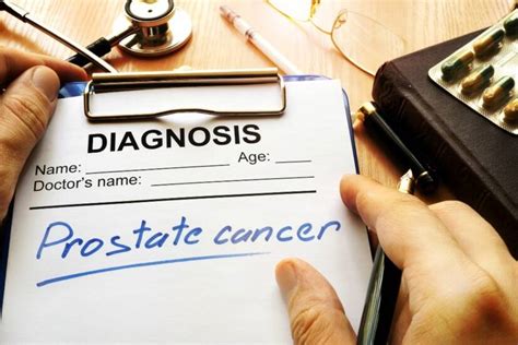Rak prostate uzroci i prvi simptomi Kakva je prognoza lečenja