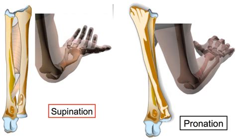 Forearm Fracture Surgery Singapore Effective Treatment Recovery