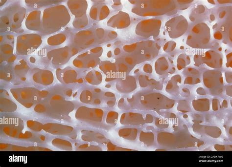 Cancellous Bone Close Up Of Normal Cancellous Spongy Bone From A