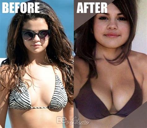 Face Plastic Surgery Mommy Makeover Surgery Hottest Celebrities Celebs Job Wishes Selena