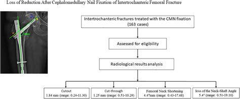 Loss Of Reduction After Cephalomedullary Nail Fixation Of