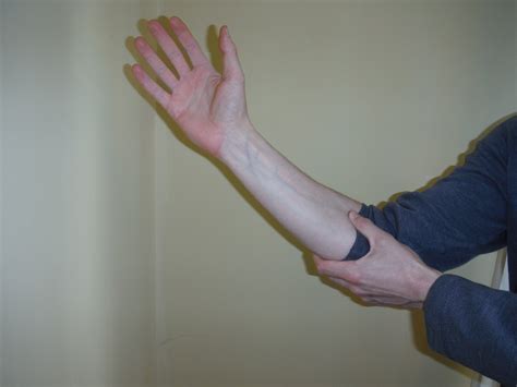 Cubital Tunnel Syndrome Sports Rehab And Wellness