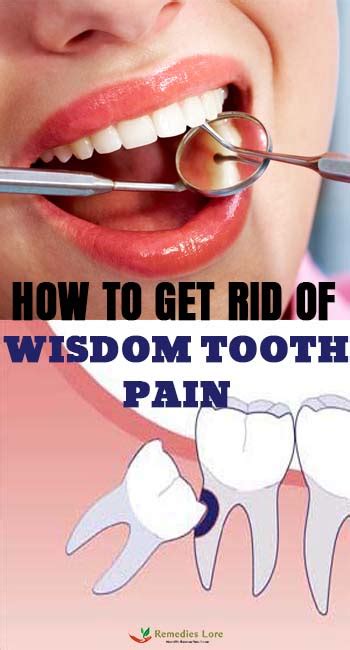 How To Get Rid Of Wisdom Tooth Pain Remedies Lore