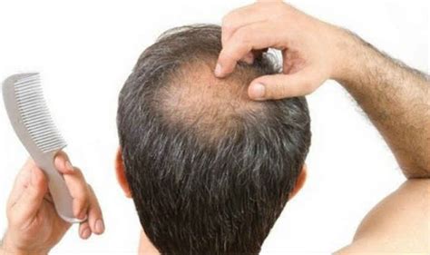 Lifestyle Habits That Are Causing Your Hair Loss India