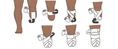 Stump Bandaging Legs4africa