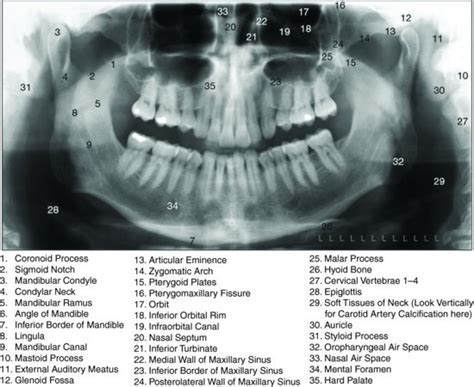 • dental radiography is required; Anatomical landmarks on panoramic radiography | Dentstudy.com