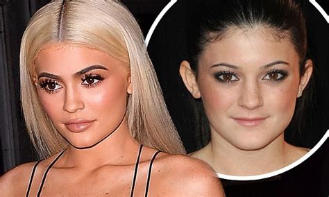 Kylie Jenner Insists Her Face Was Not Operated On At Age 16 Daily