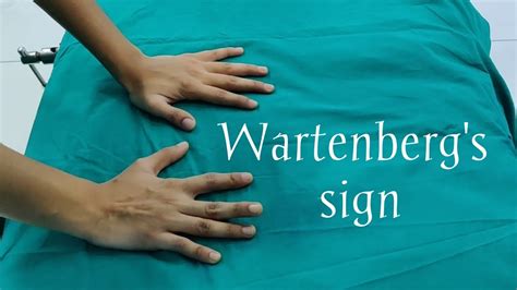 Wartenbergs Signulnar Nerve Examination Youtube