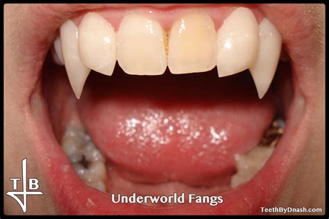 Underworld Teeth By Dnash