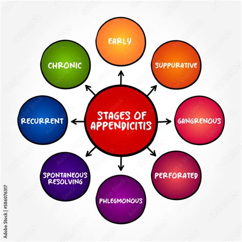 Stages Of Appendicitis Inflammation Of The Appendix Mind Map Concept