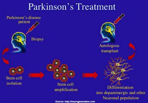 What Are Some Side Effects Of Parkinsons Disease Medications