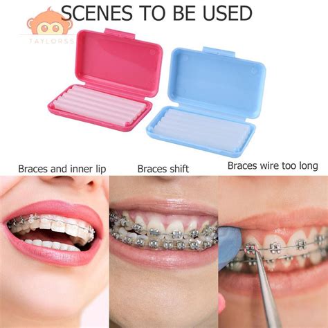 How To Use Orthodontic Wax For Braces How To Make Invisalign More