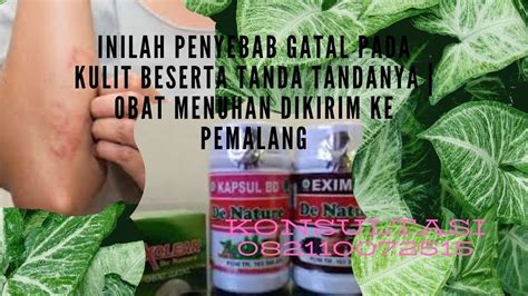 Hiv (human immunodeficiency virus) adalah virus yang menyebabkan aids. Inilah penyebab gatal pada kulit beserta tanda tandanya ...