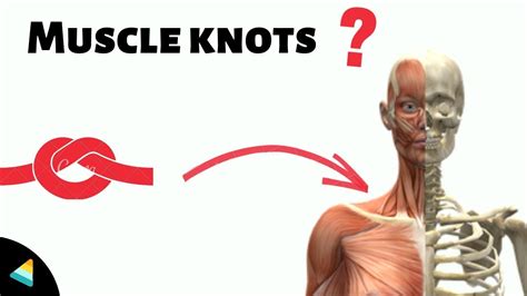 Muscle Knots Explained Why Do We Get Muscle Knots Youtube