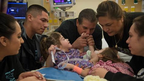 Separated Conjoined Twins Meet For First Time Since Surgery Ctv News