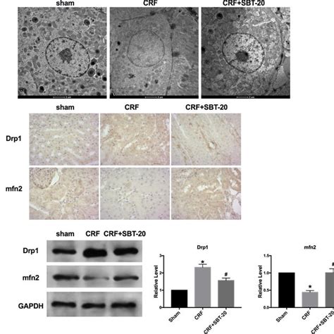 Sbt 20 Protect Mitochondria Protection In Vivo A Transmission
