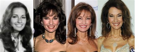 Susan Lucci Plastic Surgery Before And After Pictures
