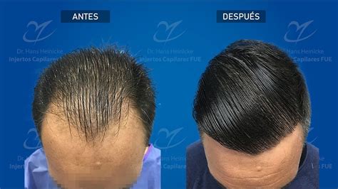 Simple Science: How to Make a Volcano with Kids