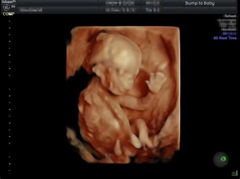 Magical Moment Unborn Baby 16 Weeks Waves And Plays Peek A Boo With