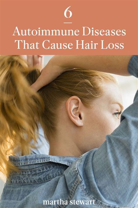 Understanding Autoimmune Disease And Hair Loss