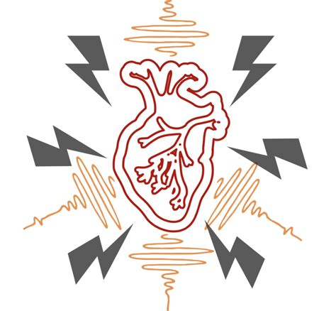 Heart failure develops when the heart, via an abnormality of cardiac function (detectable or not), fails to pump blood at a rate commensurate with the requirements of the metabolizing tissues or is able to do. Taming the SRU