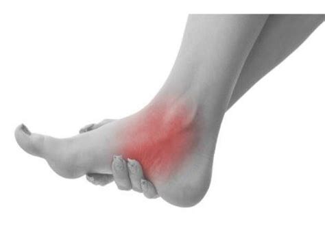 Rheumatoid Arthritis Of The Foot And Ankle Oakland Township Mi Patch