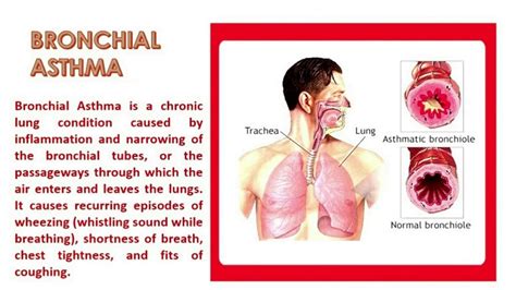 Bronchial Asthma And Wonder What It Means Youtube