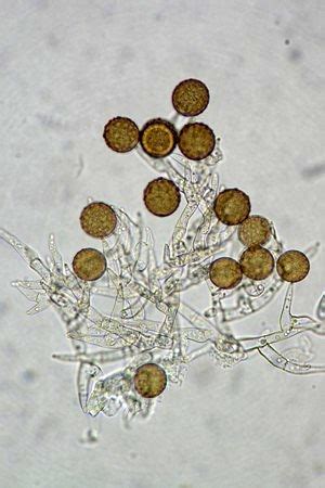 Moulds under the microscope