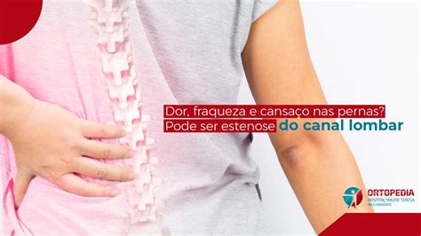 Cabra Com Fraqueza Nas Pernas
