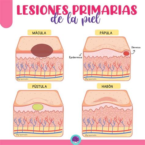 Lesiones Primarias De La Piel Piel Lesiones Udocz