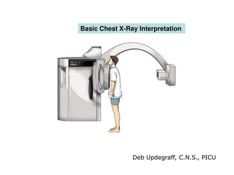 Ppt Basic Chest X Ray Interpretation Powerpoint Presentation Free