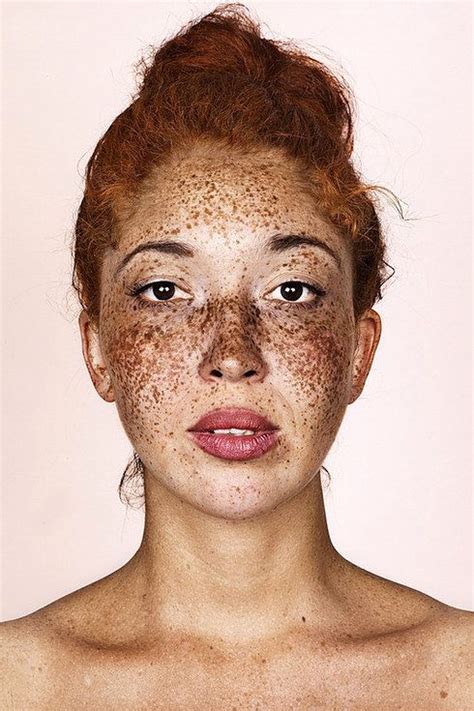 These Portraits Celebrate The Joy Of Having Freckles Freckle Photography Photography Tips