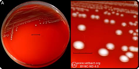 Enterococcus Faecium