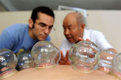 experiencing cupping therapy beijing review
