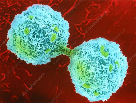 Animal cell is undergoing cytokinesis. Coloured SEM of hepatocyte undergoing cytokinesis - Stock ...