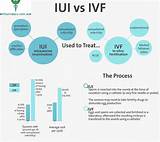 Pictures of Ivf Treatment Process Timeline