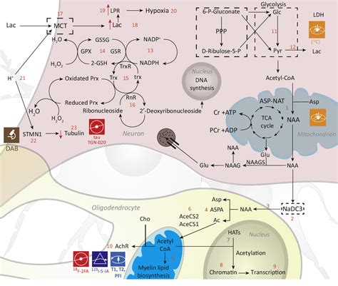 Figure 2 From Multimodal Imaging Of Neurometabolic Pathology Due To