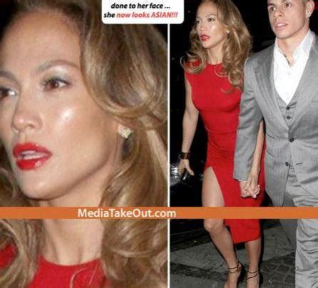 Notizie, foto e video su vincenzo mollica, tutti gli aggiornamenti il messaggero. Jennifer Lopez sfigurata dal botox, irriconoscibile!!! - FOTO